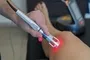 Chiropractic Laser Treatment Hitesh Manga